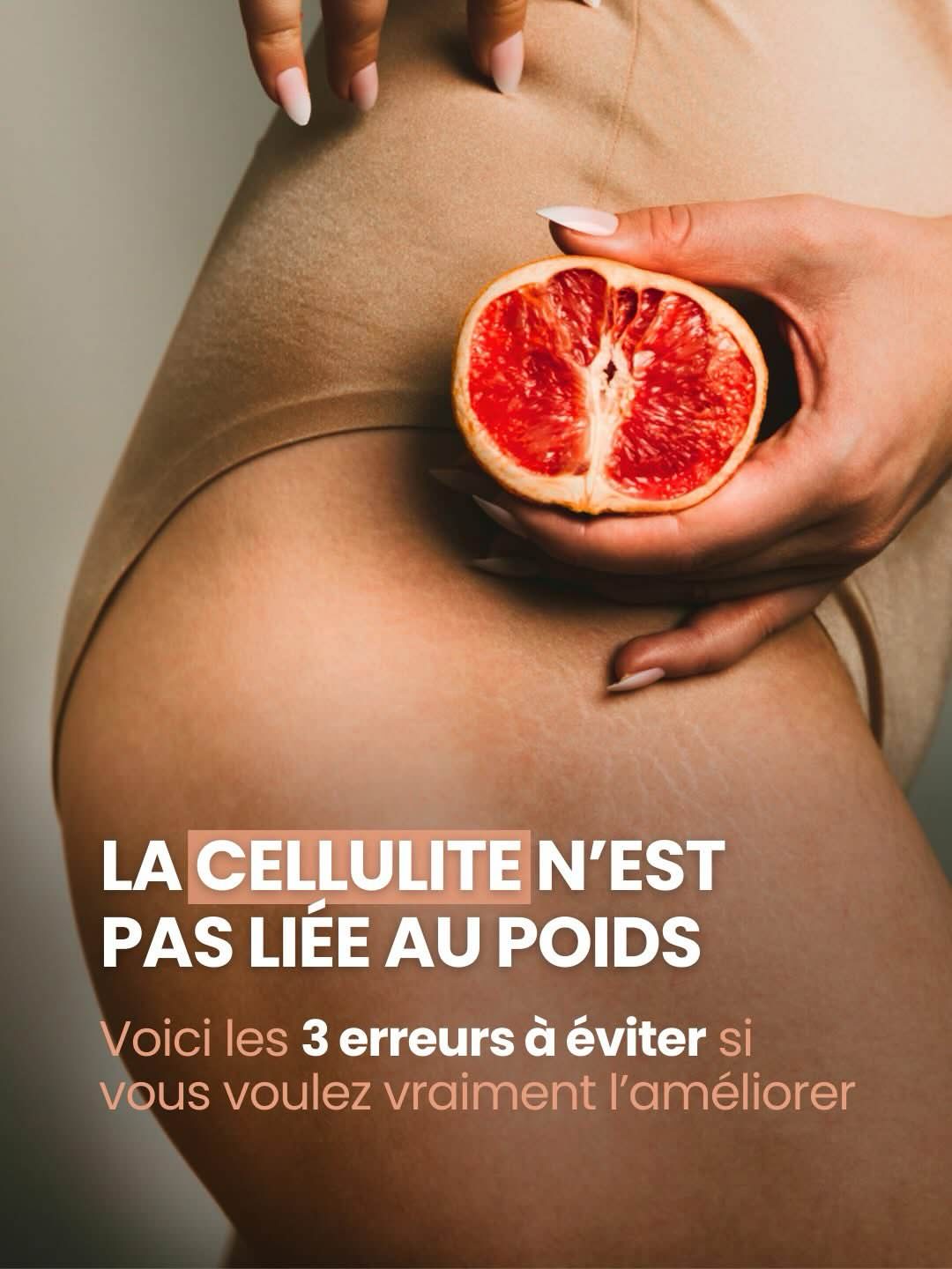 Cellulite : types et traitements