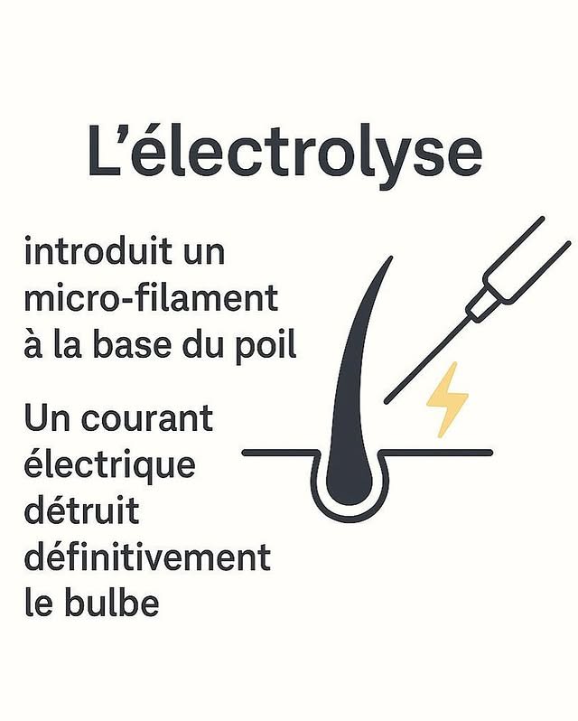 Schéma du fonctionnement de l'électrolyse sur le follicule pileux