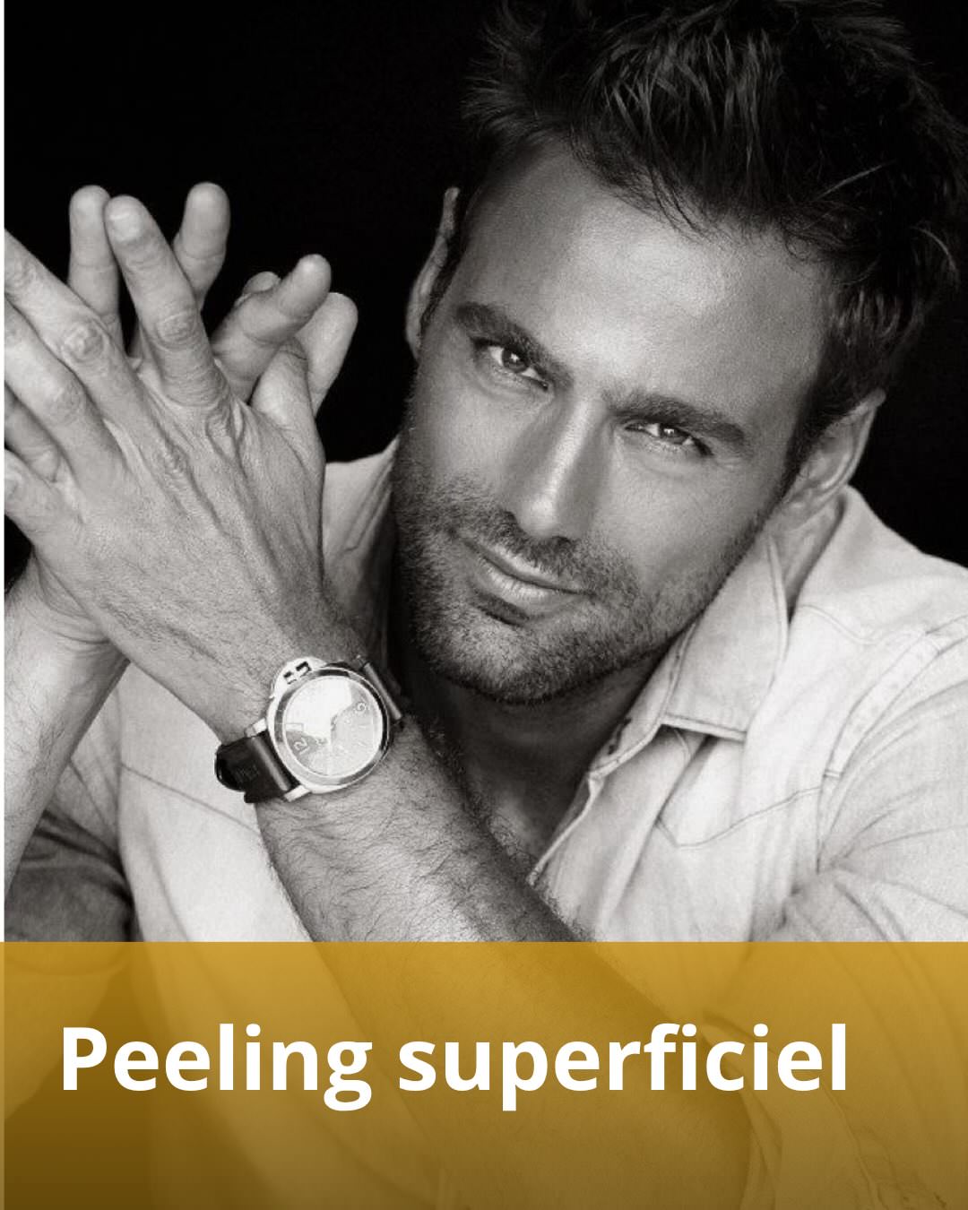 Peeling TCA moyen — résultat soin peau esthétique